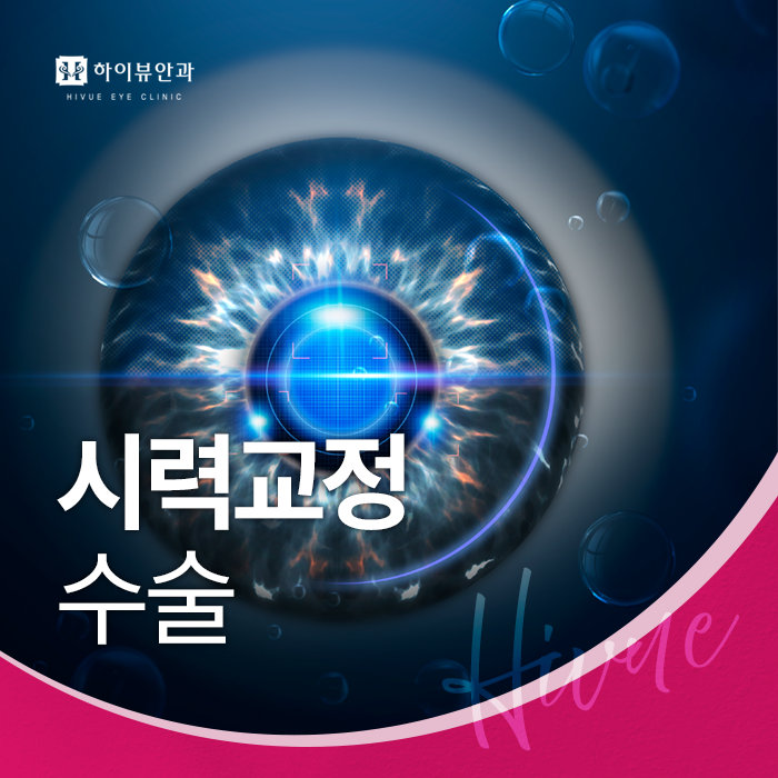 시력교정수술